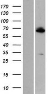 Western Blot ZNF512 Overexpression Lysate