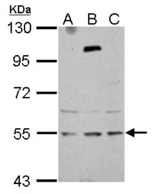 Western Blot: ZNF513 Antibody [NBP2-15175] - Sample (30 ug of whole cell lysate) A: NT2D1 B: U87-MG C: SK-N-SH 7.5% SDS PAGE; antibody diluted at 1:1000.