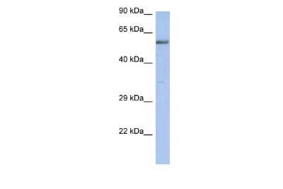 Western Blot: ZNF513 Antibody [NBP2-86508] - WB Suggested Anti-ZNF513 Antibody Titration: 0.2-1 ug/ml. ELISA Titer: 1:312500. Positive Control: Human kidney