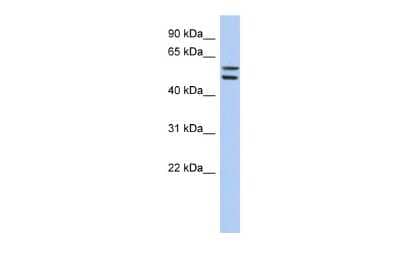 Western Blot: ZNF513 Antibody [NBP2-86509] - WB Suggested Anti-ZNF513 Antibody Titration: 0.2-1 ug/ml. ELISA Titer: 1:62500. Positive Control: HT1080 cell lysate