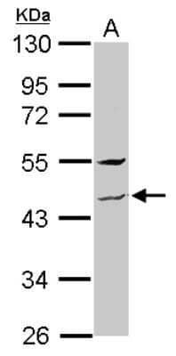 Western Blot: ZNF514 Antibody [NBP2-21022] - Sample (30 ug of whole cell lysate) A: Hep G2 10% SDS PAGE gel, diluted at 1:2000.