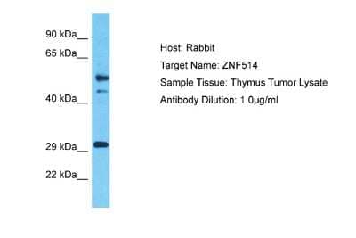 Western Blot: ZNF514 Antibody [NBP2-88700] - Host: Rabbit. Target Name: ZNF514. Sample Type: Thymus Tumor lysates. Antibody Dilution: 1.0ug/ml