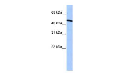 Western Blot: ZNF514 Antibody [NBP2-88702] - WB Suggested Anti-ZNF514 Antibody Titration: 0.2-1 ug/ml. Positive Control: Hela cell lysate