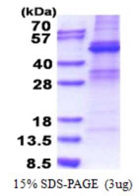 SDS-Page: ZNF514 Protein [NBP2-22957]