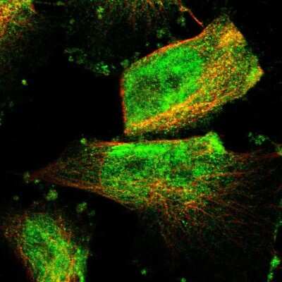 Immunocytochemistry/ Immunofluorescence ZNF516 Antibody - BSA Free