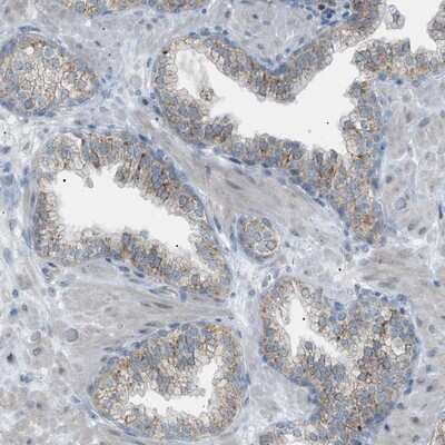 Immunohistochemistry-Paraffin ZNF516 Antibody - BSA Free