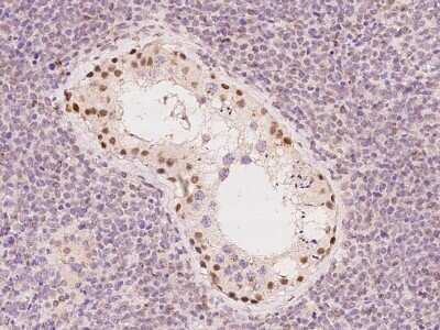 Immunohistochemistry-Paraffin ZNF516 Antibody - BSA Free