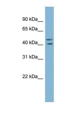 Western Blot ZNF517 Antibody - BSA Free