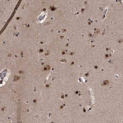 Immunohistochemistry: ZNF518B Antibody [NBP1-81379] - Staining of human cerebral cortex shows strong nuclear positivity in neuronal and glial cells.