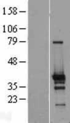 Western Blot ZNF524 Overexpression Lysate
