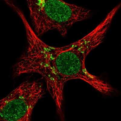 Immunocytochemistry/Immunofluorescence: ZNF526 Antibody [NBP2-32007] - Immunofluorescent staining of human cell line A549 shows localization to nucleus & the Golgi apparatus.