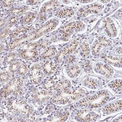 Immunohistochemistry: ZNF526 Antibody [NBP2-32007] - Staining of human stomach, upper shows strong cytoplasmic positivity in dot like pattern in glandular cells.