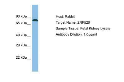 Western Blot: ZNF526 Antibody [NBP2-88705] - Host: Rabbit. Target Name: ZNF526. Sample Type: Fetal Kidney lysates. Antibody Dilution: 1.0ug/ml