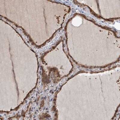 Immunohistochemistry ZNF527 Antibody - BSA Free