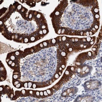 Immunohistochemistry-Paraffin ZNF527 Antibody - BSA Free