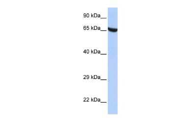 Western Blot: ZNF528 Antibody [NBP3-10389] - Western blot analysis using NBP3-10389 on Human HepG2 as a positive control. Antibody Titration: 0.2-1 ug/ml