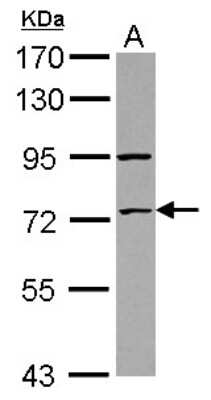 Western Blot: ZNF530 Antibody [NBP2-21023] - Sample (30 ug of whole cell lysate) A: IMR32 7. 5% SDS PAGE gel, diluted at 1:1000.