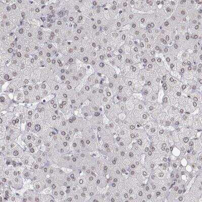 Immunohistochemistry-Paraffin ZNF532 Antibody - BSA Free