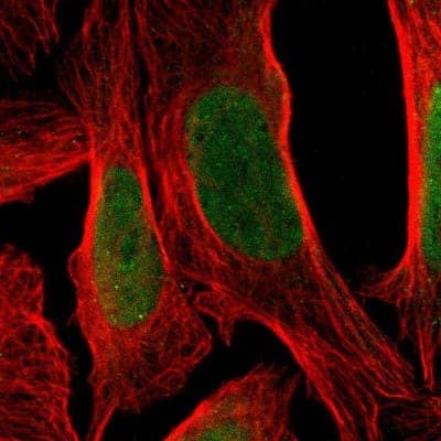 Immunocytochemistry/Immunofluorescence: ZNF537 Antibody [NBP1-92629] - Staining of human cell line U-2 OS shows localization to nucleoplasm. Antibody staining is shown in green.