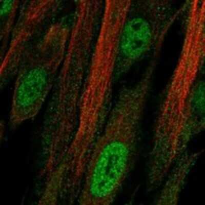 Immunocytochemistry/Immunofluorescence: ZNF537 Antibody [NBP3-17329] - Staining of human cell line ASC TERT1 shows localization to nucleoplasm & plasma membrane.