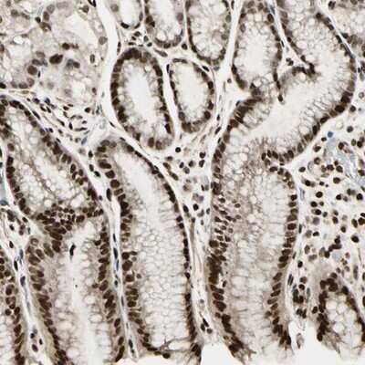 Immunohistochemistry-Paraffin: ZNF537 Antibody [NBP1-92629] - Staining of human stomach shows strong nuclear and moderate cytoplasmic positivity in glandular cells.