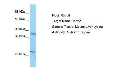 Western Blot: ZNF537 Antibody [NBP2-83864] - Host: Rabbit. Target Name: Tshz2. Sample Type: Mouse Liver lysates. Antibody Dilution: 1.0ug/ml