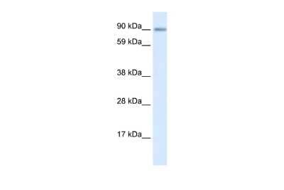 Western Blot: ZNF537 Antibody [NBP2-83865] - WB Suggested Anti-ZNF537 Antibody Titration: 0.2-1 ug/ml. Positive Control: Human Lung