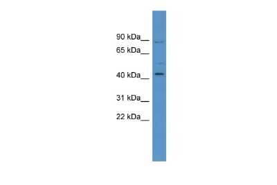 Western Blot: ZNF540 Antibody [NBP2-83866] - WB Suggested Anti-ZNF540 Antibody Titration: 0.2-1 ug/ml. ELISA Titer: 1:1562500. Positive Control: HT1080 cell lysate