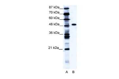 Western Blot: ZNF541 Antibody [NBP2-86510] - WB Suggested Anti-ZNF541 Antibody Titration: 1.25ug/ml. ELISA Titer: 1:1562500. Positive Control: Jurkat cell lysate