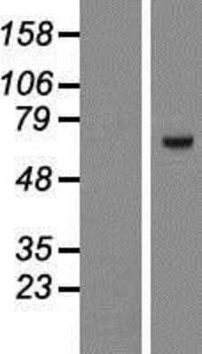 Western Blot: ZNF543 Overexpression Lysate (Adult Normal) [NBP2-04477] Left-Empty vector transfected control cell lysate (HEK293 cell lysate); Right -Over-expression Lysate for ZNF543.