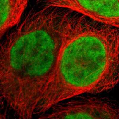 Immunocytochemistry/Immunofluorescence: ZNF544 Antibody [NBP1-89224] - Immunofluorescent staining of human cell line A-431 shows localization to nucleoplasm.