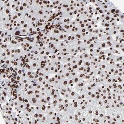 Immunohistochemistry-Paraffin: ZNF544 Antibody [NBP1-89224] - Staining of human liver shows strong nuclear positivity in hepatocytes and bile duct cells.