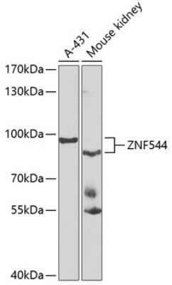 Western Blot ZNF544 Antibody - BSA Free