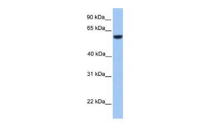 Western Blot: ZNF545 Antibody [NBP2-86511] - WB Suggested Anti-ZNF545 Antibody Titration: 0.2-1 ug/ml. ELISA Titer: 1:62500. Positive Control: Human brain
