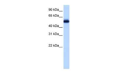 Western Blot: ZNF545 Antibody [NBP2-86512] - WB Suggested Anti-ZNF545 Antibody Titration: 0.2-1 ug/ml. ELISA Titer: 1:12500. Positive Control: Transfected 293T