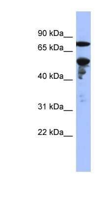 Western Blot: ZNF549 Antibody [NBP1-80425] - Titration: 0.2-1 ug/ml, Positive Control: NCI-H226 cell lysate.