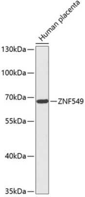 Western Blot: ZNF549 Antibody [NBP3-04628] - Analysis of extracts of Human placenta, using ZNF549 antibody at 1:1000 dilution. Secondary antibody: HRP Goat Anti-Rabbit IgG (H+L) at 1:10000 dilution. Lysates/proteins: 25ug per lane. Blocking buffer: 3% nonfat dry milk in TBST. Detection: ECL Basic Kit