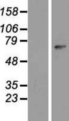 Western Blot: ZNF549 Overexpression Lysate (Adult Normal) [NBP2-05270] Left-Empty vector transfected control cell lysate (HEK293 cell lysate); Right -Over-expression Lysate for ZNF549.