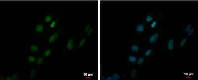Immunocytochemistry/Immunofluorescence: ZNF550 Antibody [NBP2-21025] - NT2D1 cells were fixed in 4% paraformaldehyde at RT for 15 min. Green: ZNF550 protein stained by ZNF550 antibody  diluted at 1:500. Blue: Hoechst 33342 staining. Scale bar = 10 um.