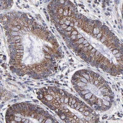 Immunohistochemistry-Paraffin: ZNF550 Antibody [NBP1-86158] - Staining of human stomach shows cytoplasmic positivity in glandular cells.