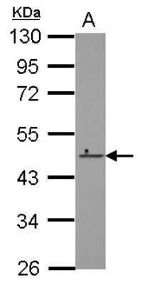 Western Blot: ZNF550 Antibody [NBP2-21025] - Sample (30 ug of whole cell lysate) A: K562 10% SDS PAGE gel, diluted at 1:1000.