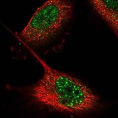 Immunocytochemistry/ Immunofluorescence ZNF551 Antibody - BSA Free