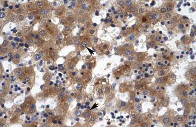 Immunohistochemistry-Paraffin: ZNF551 Antibody [NBP1-80139] - Human Liver Tissue, antibody concentration 4-8ug/ml. Cells with positive label: Hepatocytes (indicated with arrows) 400X magnification.