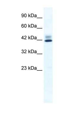 Western Blot: ZNF551 Antibody [NBP1-80139] - Jurkat cell lysate, Antibody Titration: 0.6ug/ml