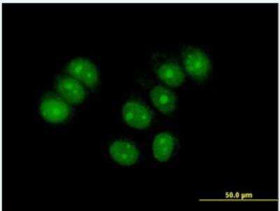 Immunocytochemistry/Immunofluorescence: ZNF554 Antibody [H00115196-B01P-50ug] - Purified MaxPab antibody to ZNF554 on MCF-7 cell. [antibody concentration 10 ug/ml]