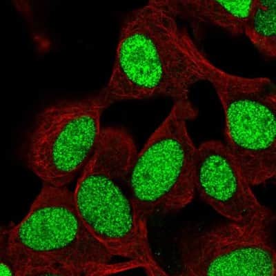 Immunocytochemistry/ Immunofluorescence ZNF554 Antibody - BSA Free
