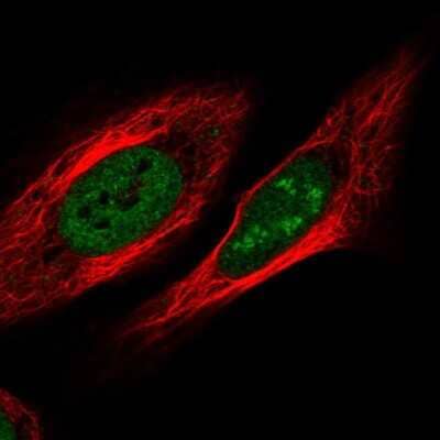 Immunocytochemistry/Immunofluorescence: ZNF554 Antibody [NBP2-55914] - Staining of human cell line U-2 OS shows localization to nucleus & nucleoli.