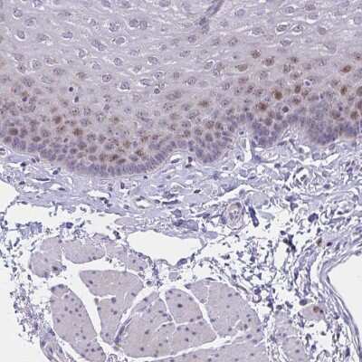 Immunohistochemistry-Paraffin: ZNF554 Antibody [NBP2-32519] - Staining of human esophagus shows moderate nuclear positivity in squamous epithelial cells.