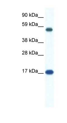 Western Blot: ZNF554 Antibody [NBP1-80149] - Titration: 0.2-1 ug/ml, Positive Control: Human Placenta.