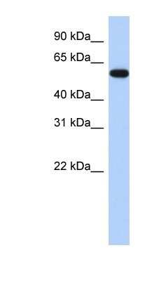 Western Blot: ZNF554 Antibody [NBP1-80401] - MCF-7 whole cell lysates, concentration 0.2-1 ug/ml.